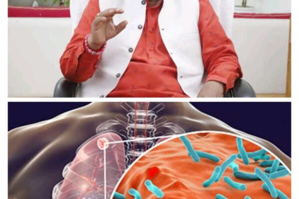 टीबी की बीमारी से जुड़ी बड़ी खबर, 1400 से ज्यादा ग्राम पंचायतें हुई टीबी मुक्त